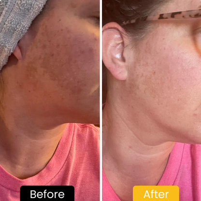 Lemon Turmeric & Kojic Acid Brightening Soap