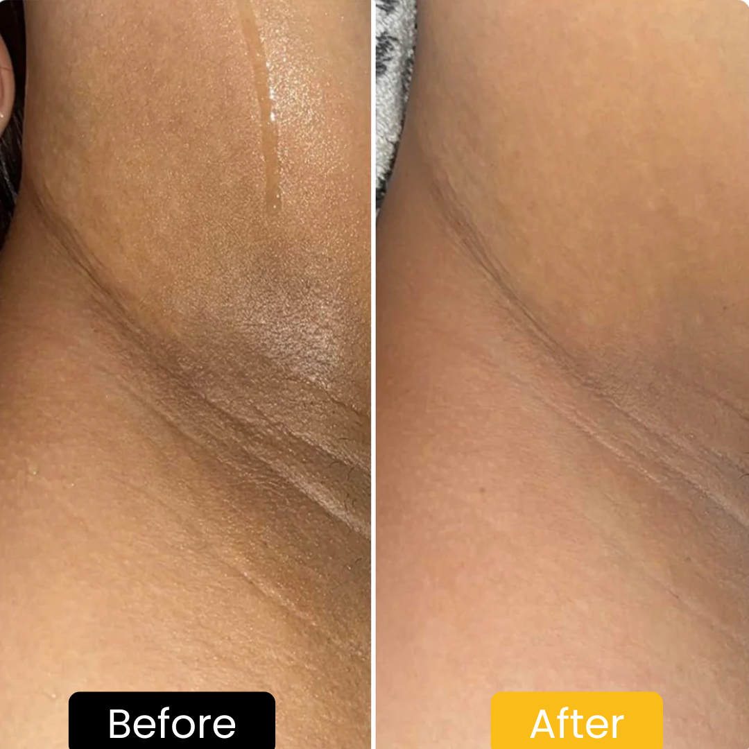 Lemon Turmeric & Kojic Acid Brightening Soap