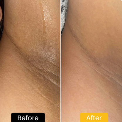 Lemon Turmeric & Kojic Acid Brightening Soap