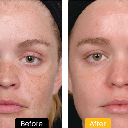 Lemon Turmeric & Kojic Acid Brightening Soap