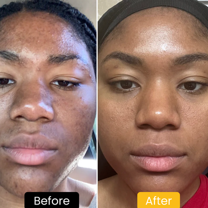 Lemon Turmeric & Kojic Acid Brightening Soap