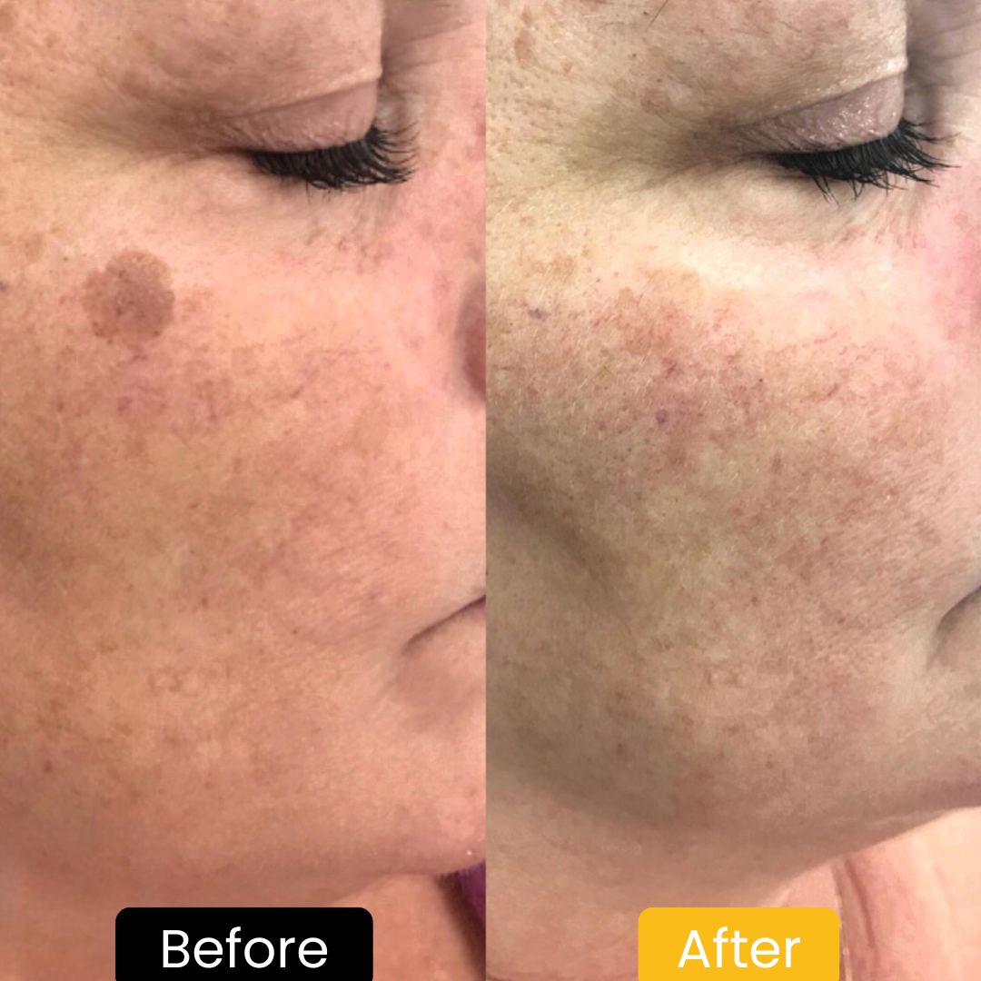 Lemon Turmeric & Kojic Acid Brightening Soap