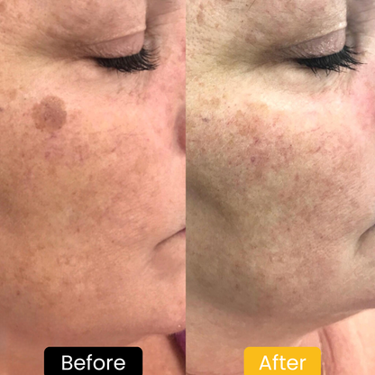 Lemon Turmeric & Kojic Acid Brightening Soap